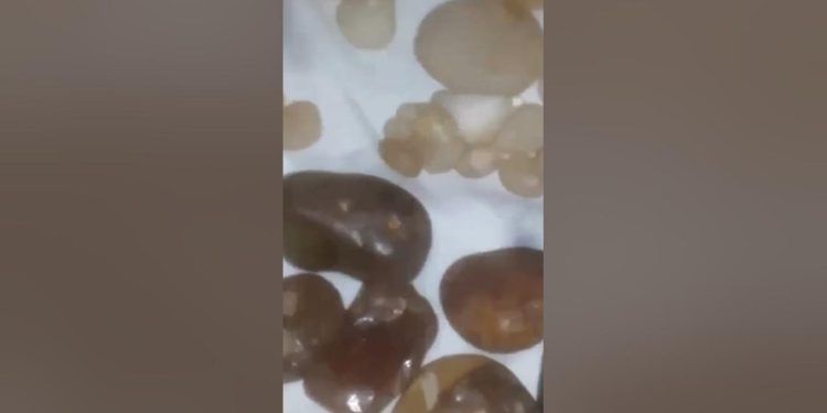 الشقف-الفرعوني